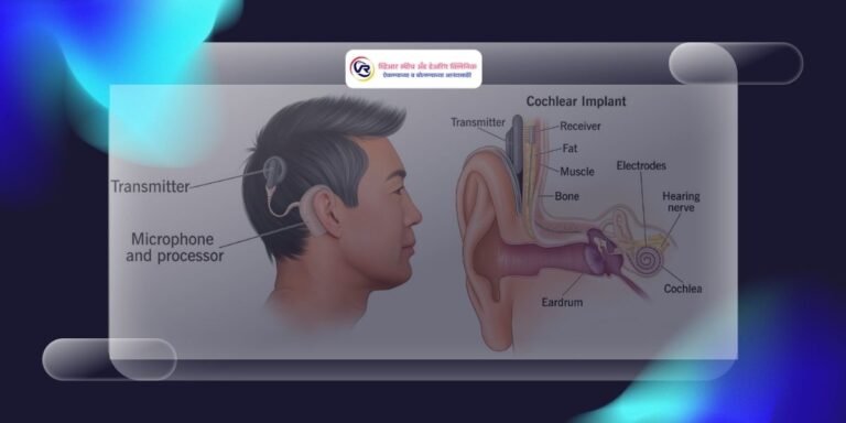 Cochlear Implants: Benefits, Cost in India, Eligibility, Procedure & Recovery Guide