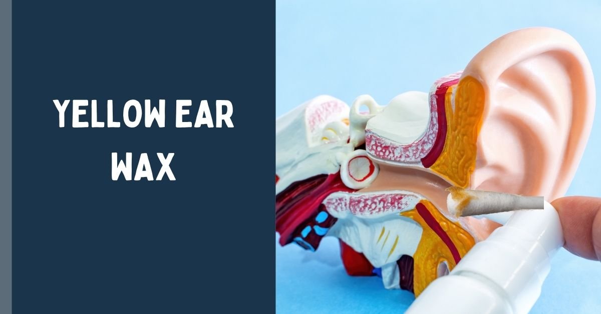 Bright Yellow Ear Wax: What It Means, Causes, Treatment & When to See a Doctor