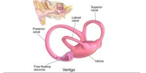 Balance Disorders: Causes, Symptoms, Diagnosis & Treatment – Complete Guide