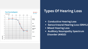 Best Invisible Hearing Aids 2026